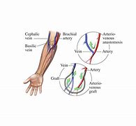 Image result for Vein Matching