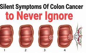 Image result for Colon Cancer Symptoms
