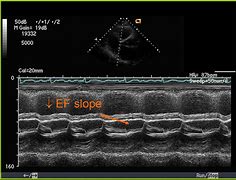 Image result for Old Sharp TV Check for Mercury Valve