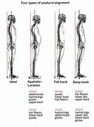 Image result for Posture Alignment
