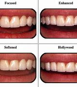 Image result for Blunt Sharp Teeth