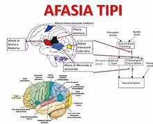 Image result for afasia