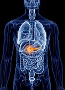 Image result for X-ray of Pancreatic Cancer