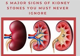 Image result for Red Kidney Stones