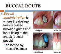 Image result for Sublingual Administration
