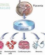 Image result for Placenta Stem Cells Pros and Cons