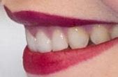 Image result for Cara Delevingne Teeth