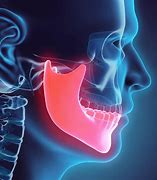 Image result for Jawbone Teeth