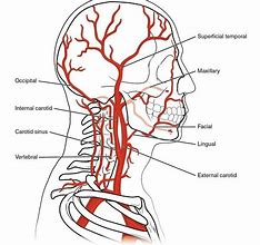 Image result for External Carotid Artery Angiogram