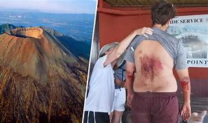 Image result for Mount Vesuvius Before and After