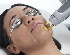 Image result for Laser Hair Removal Face