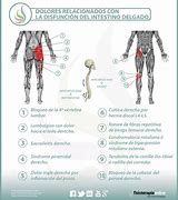 Image result for Igual Hernia