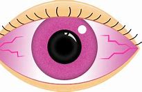 Image result for Pink Eyes Cartoon