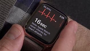 Image result for ECG Reader Apple Watch