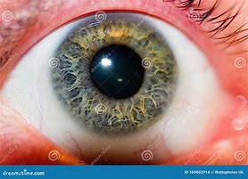 Image result for Men Eye Pupil