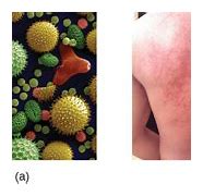 Image result for Pollen Allergy Rash