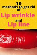 Image result for Wart On Lip Line