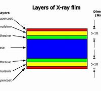 Image result for X-ray Film