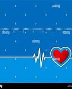 Image result for cardiograms
