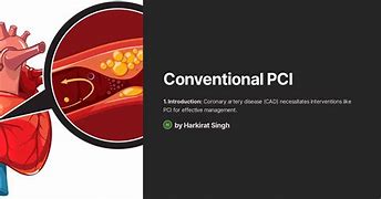 Image result for Conventional PCI