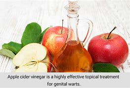 Image result for How to Kill Genital Wart with ACV