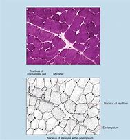 Image result for Tissue Histology Embedding