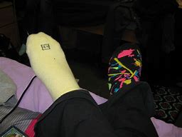 Image result for Emo Mismatched Sock