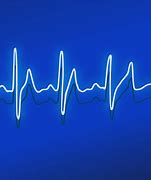 Image result for HeartBeat Monitor