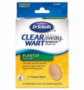 Image result for Wart Remover for Feet