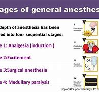 Image result for General Anesthesia Stages