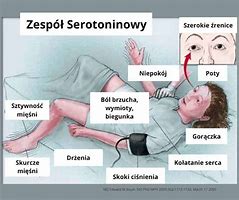 Image result for co_to_za_zespół_serotoninowy