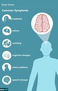 Image result for Brain Tumor Headache Symptoms