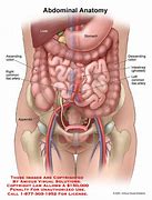 Image result for Intestines Coming Out of Stomach