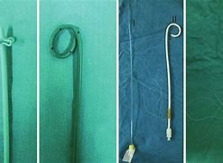 Image result for Ir Drain Catheter