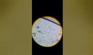 Image result for Snimki Na Voda Pod Mikroskop