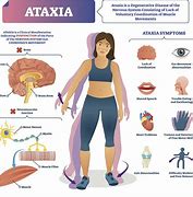 Image result for acataxura