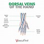 Image result for Grip Claw of Veins