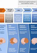 Image result for Brain with Alzheimer's Disease