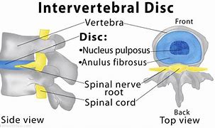 Image result for interveetebral