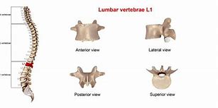 Image result for L1 Lumbar Vertebra Symptons