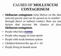 Image result for Molluscum Contagiosum Virus On Kids