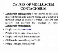 Image result for Molluscum Contagiosum Contagious