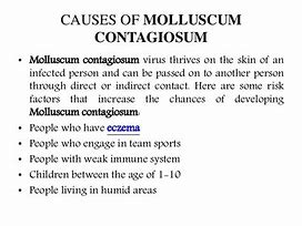 Image result for Molluscum Contagiosum African American