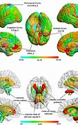 Image result for Male vs Female Brain Differences