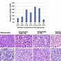 Image result for Large B-cell Papilloma