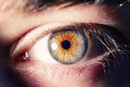 Image result for Light Blue Ring around Iris