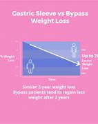 Image result for Bypass Weight Loss Surgery