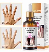 Image result for Hand Cream for Dark Knuckles