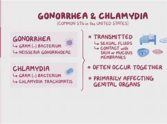 Image result for Gonorrhea and Chlamydia Naat