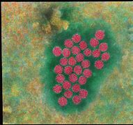 Image result for Wart Virus